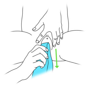 5.Hand cleaning around the meatus-girl