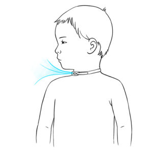 587.Child with trach external view