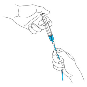 9.Hand cleaning the urinary catheter with syringe