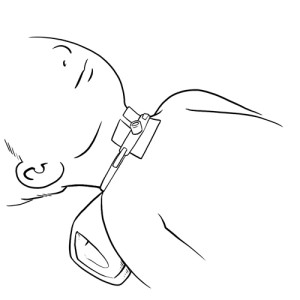 Tracheostomy dressing in place